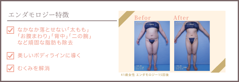 エンダモロジーアライアンスビフォーアフター