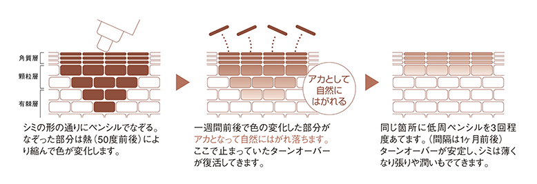 ターンオーバー美肌再生仕組み